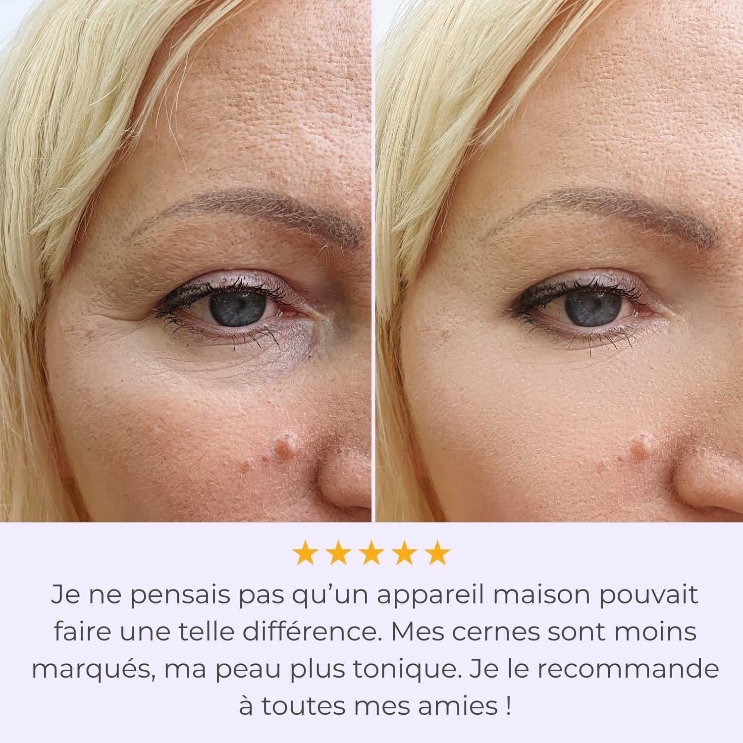 LumiEyes™ - Technologie Anti-Cernes