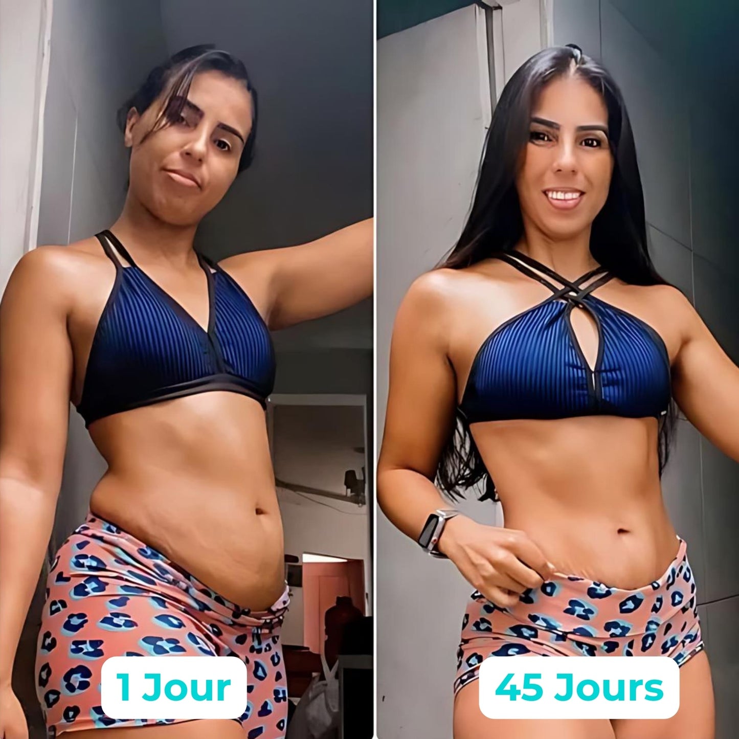 Vibraskin® - Améliore l'apparence de la peau