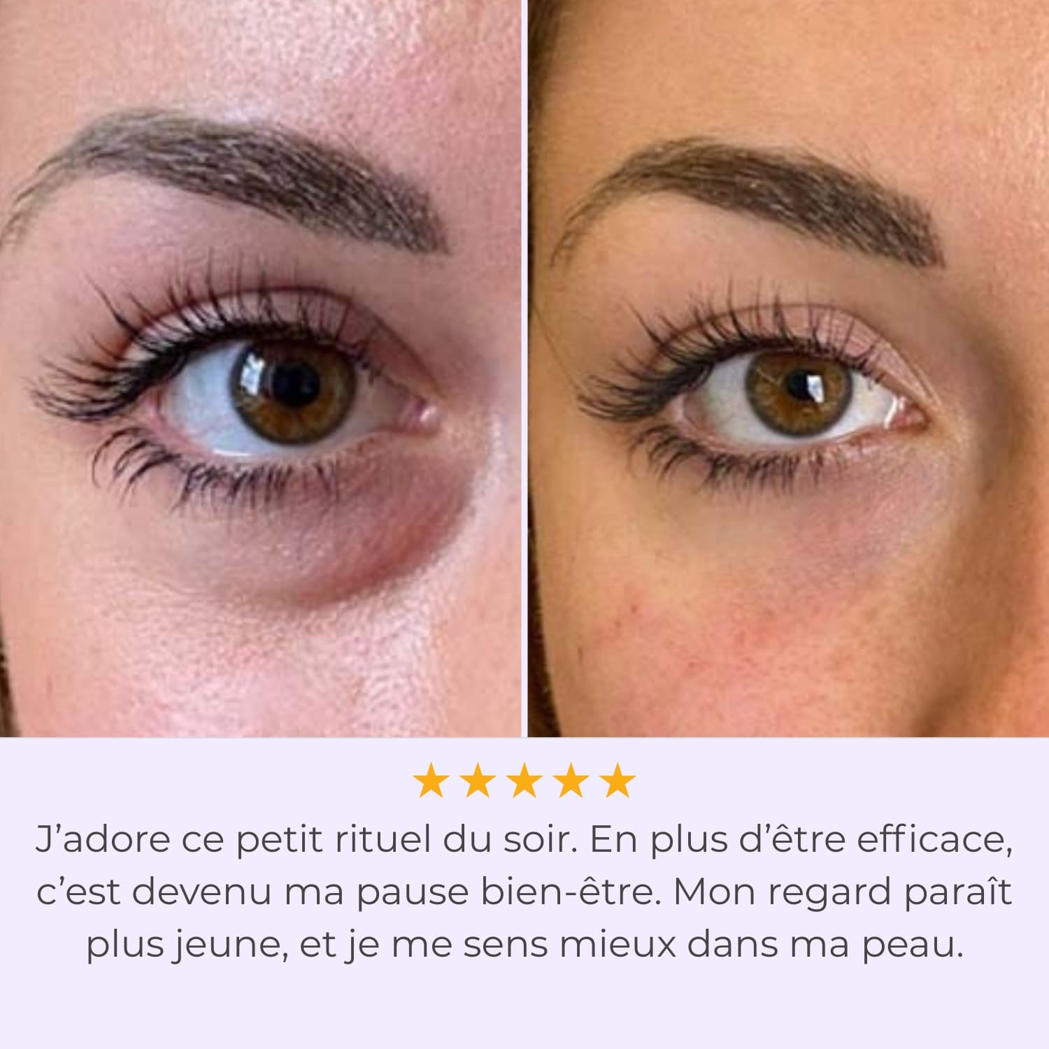 LumiEyes™ - Technologie Anti-Cernes