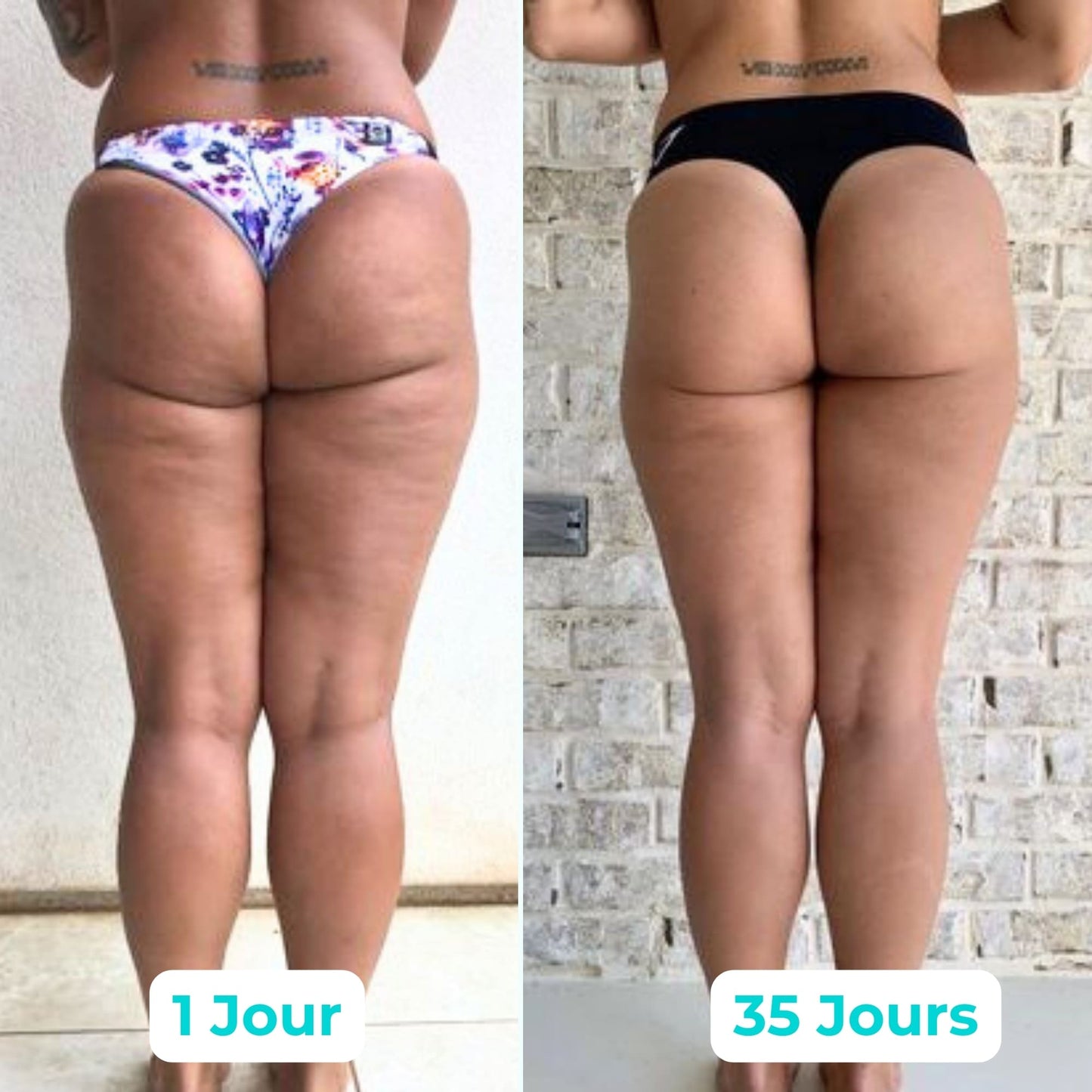 Vibraskin® - Améliore l'apparence de la peau