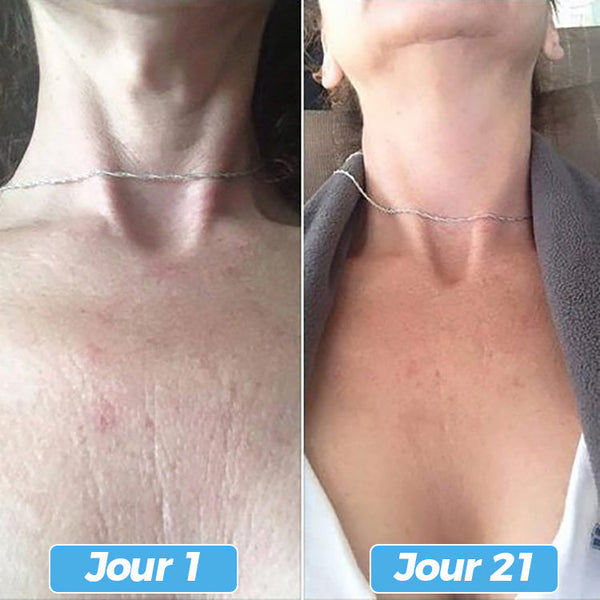 Glowskin Pro2 - Masque LED Soin Visage & Cou